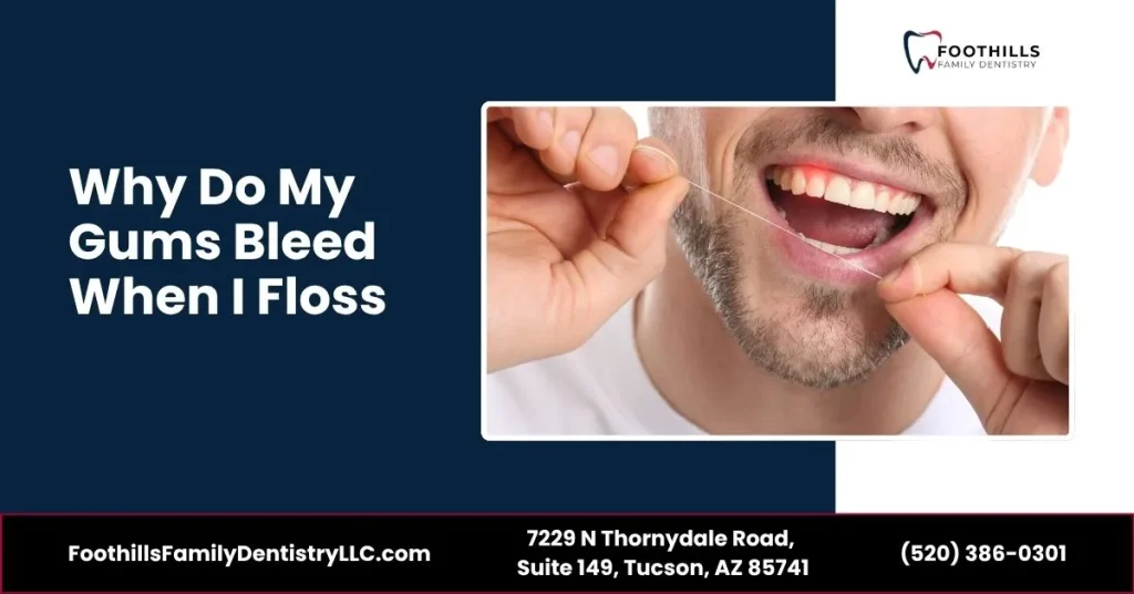 Why Do My Gums Bleed When I Floss