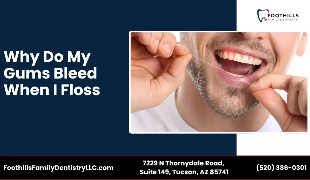 Why Do My Gums Bleed When I Floss